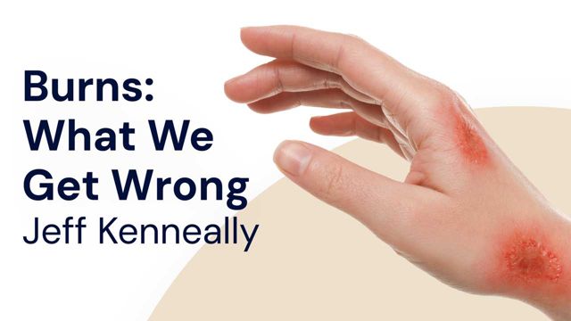 Cover image for: Burns: What We Get Wrong